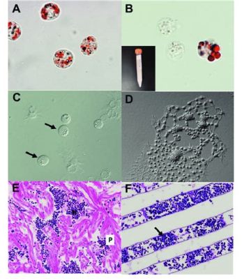  Hematodinium! A Microscopic Marvel That Makes Crabs Go Bonkers