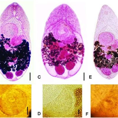  Heterophyes Heterophyes: A Tiny Trematode That Might Just Make You Think Twice About That Sushi!