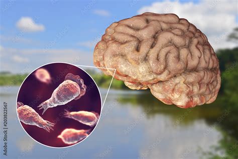  Naegleria Fowleri: Một Ký Sinh Trùng Quái Dị Hay Một Siêu Anh Hùng Bất Đắc Dĩ Trong Thế Giới Vi Khuẩn?