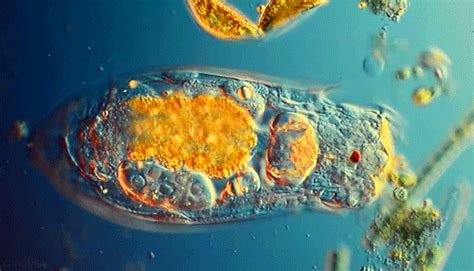  Paramecium:  A Tiny, Hairy Swimmer That Dances Through the Microscopic World!