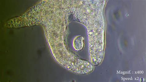  Reticulomyxa:  The Unassuming Amoeba That Eats Like It Has an Appetite for Infinity!