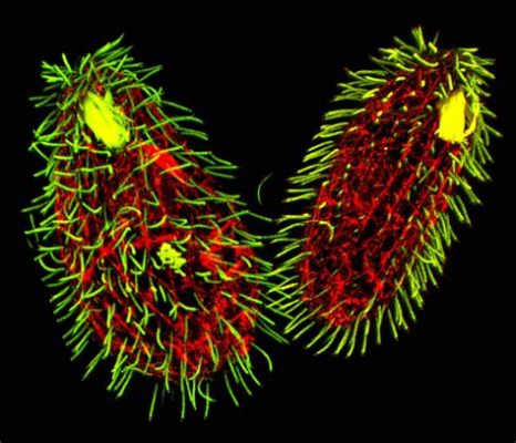  Tetrahymena! A Tiny Powerhouse With Countless Cilia