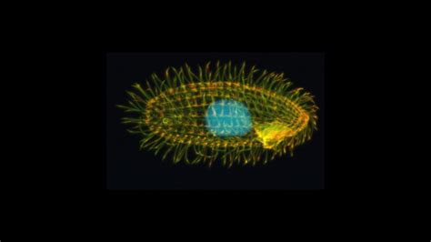  Tetrahymena: The Microscopic Marvel That Swims With Thousands of Tiny Hairs!