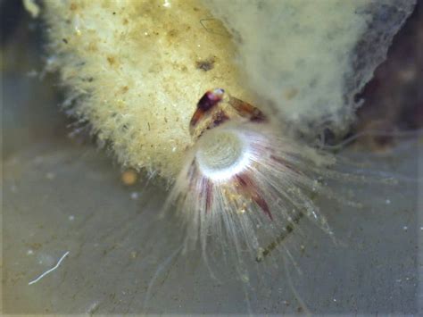  Urotrichia:  A Microscopic Marvel With Hairy Appendages that Help it Swim Like a Tiny Olympian!