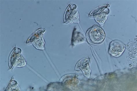  Vorticella:  A Microscopic Marvel That Moves Like A Tiny Ballerina With Flagella!