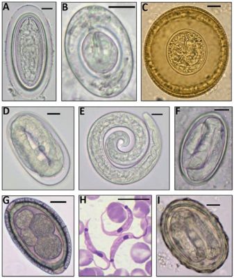  Wittichiella! Unleashing the microscopic world of these fascinating parasitic protozoans