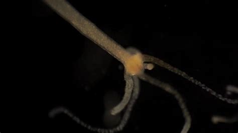  Zoothamnium:  A Tiny Hairy Behemoth That Engulfs Its Prey with Microscopic Tentacles!